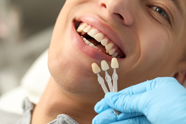 Is Dental Bonding An Option For Damaged Enamel?