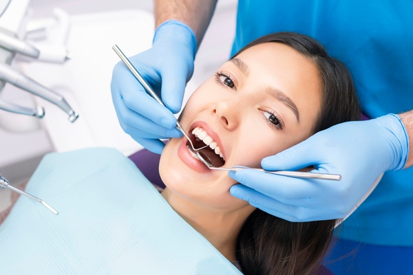 When Is An In Office Teeth Whitening Treament Recommended?